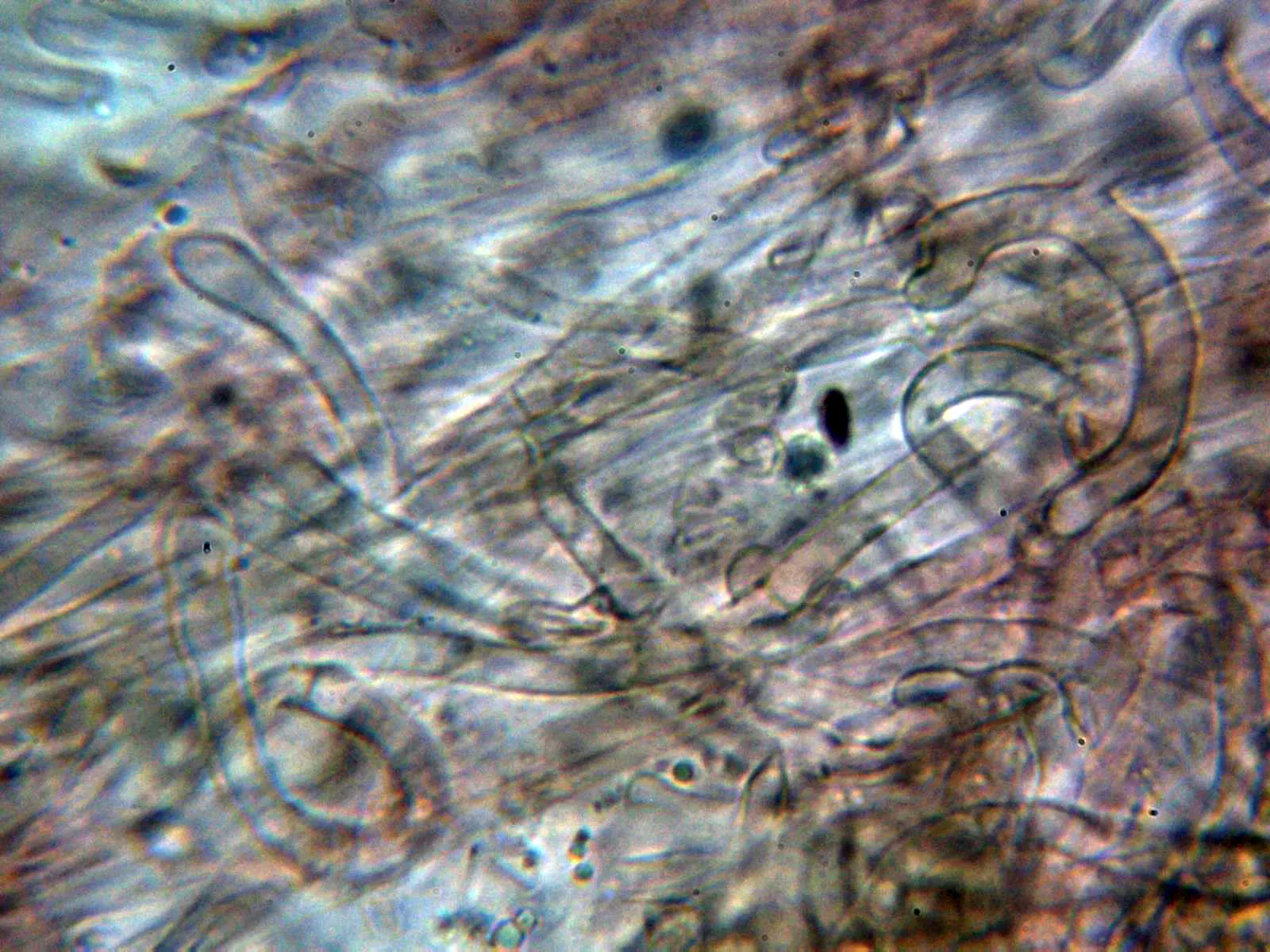 Microscopía de Lyophyllum semitale - 10 - Suprapellis 2 (2)